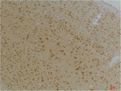 Kv1.8 Polyclonal Antibody