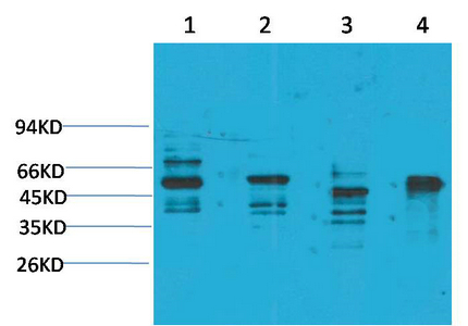 KCNN4 (SK4) Polyclonal Antibody