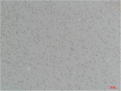 KCNN4 (SK4) Polyclonal Antibody