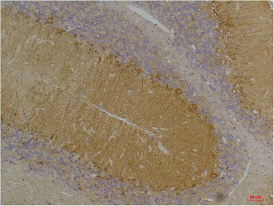 KCNN3 (SK3) Polyclonal Antibody