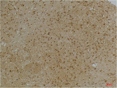 KCNN2 (SK2) Polyclonal Antibody