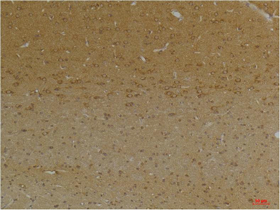 KCNK9 (TASK-3) Polyclonal Antibody