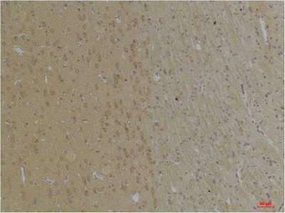 KCNK4 (TRAAK) Polyclonal Antibody