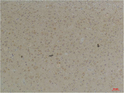 KCNK4 (TRAAK) Polyclonal Antibody