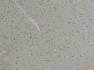 KCNK10 (TREK-2) Polyclonal Antibody