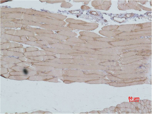 IGFN1 Polyclonal Antibody