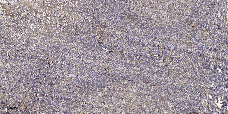 HAO1 Polyclonal Antibody