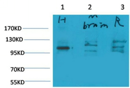 Glutamate Receptor 1 Polyclonal Antibody