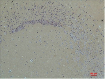 Glutamate Receptor 1 Polyclonal Antibody