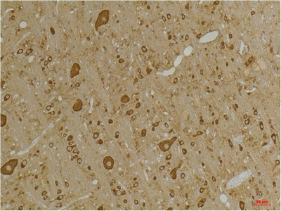 GABA A Receptor γ2 Polyclonal Antibody