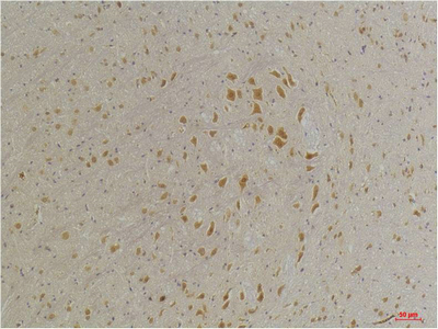 GABA A Receptor α4 Polyclonal Antibody