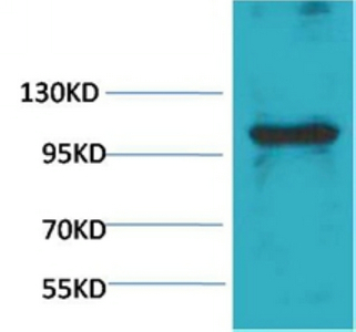 eEF1A2 binding protein Polyclonal Antibody