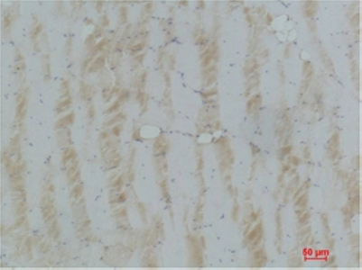 eEF1A2 binding protein Polyclonal Antibody