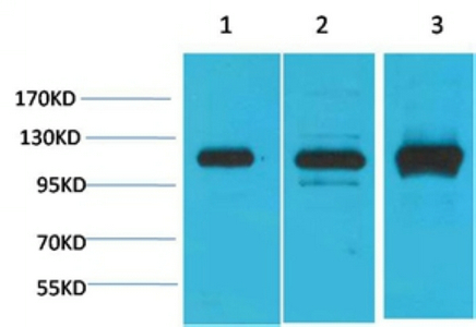 CaVα2δ2 Polyclonal Antibody