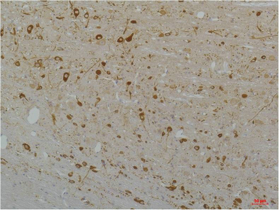 Cav1.3 Polyclonal Antibody