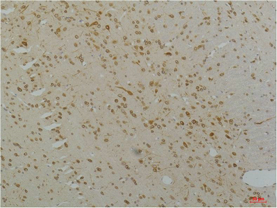 Cav1.2 Polyclonal Antibody