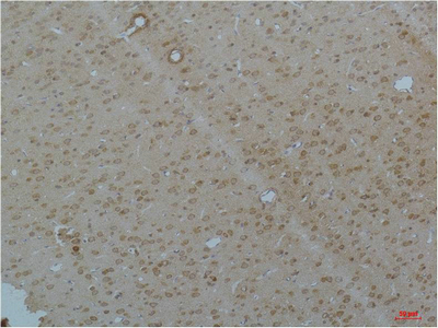 Cav pan α1 Polyclonal Antibody