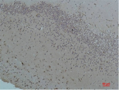 Bestrophin-1 Polyclonal Antibody
