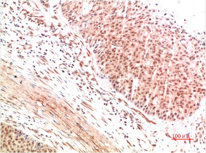 ATM Rabbit Polyclonal Antibody