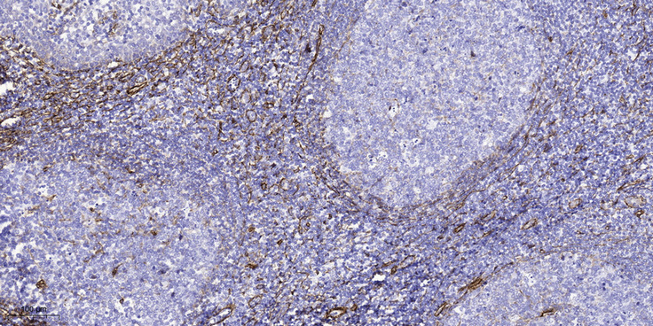 ATG4a Rabbit Polyclonal Antibody