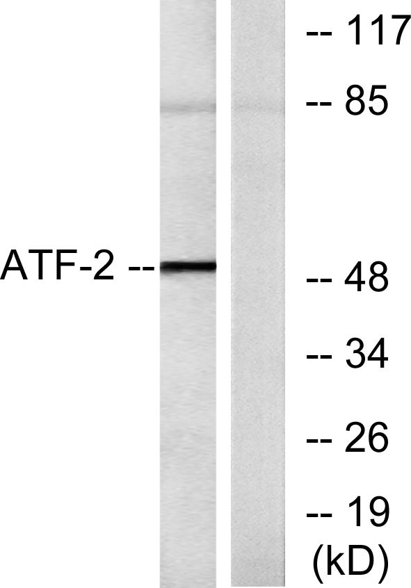 ATF-2 Polyclonal Antibody