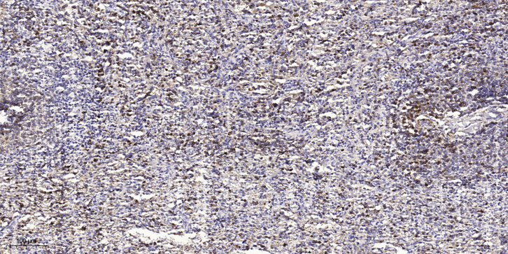 ST2A1 Polyclonal Antibody
