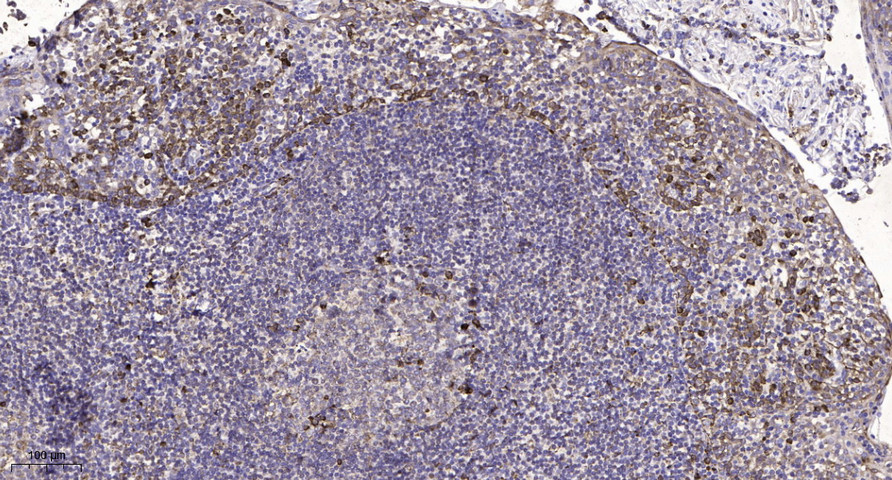SCN1A Polyclonal Antibody