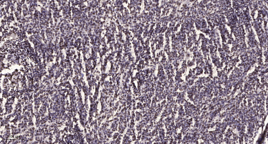 ITK Polyclonal Antibody