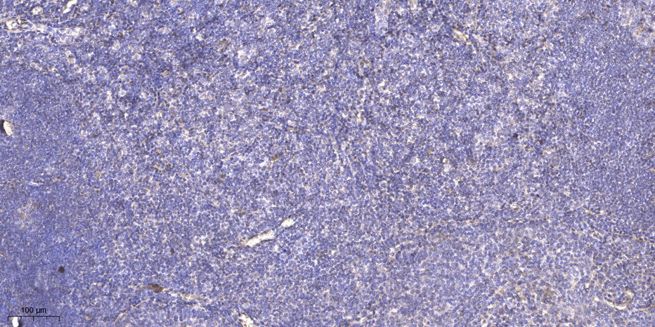 RPAB4 Polyclonal Antibody