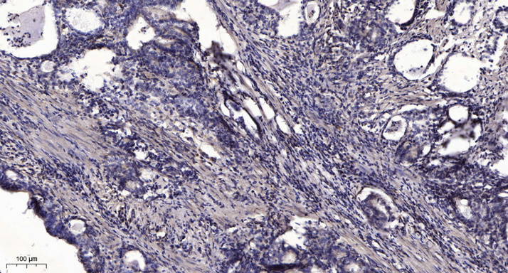 NDUFA1 Polyclonal Antibody