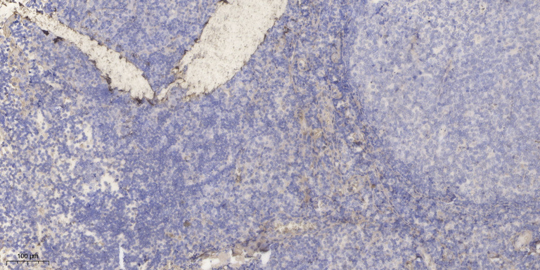 APOC2 Polyclonal Antibody