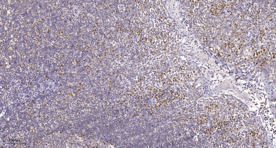 SUMO2 Polyclonal Antibody