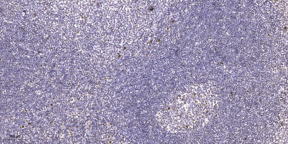 LSM2 Polyclonal Antibody