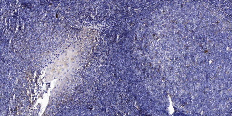 CCL18 Polyclonal Antibody