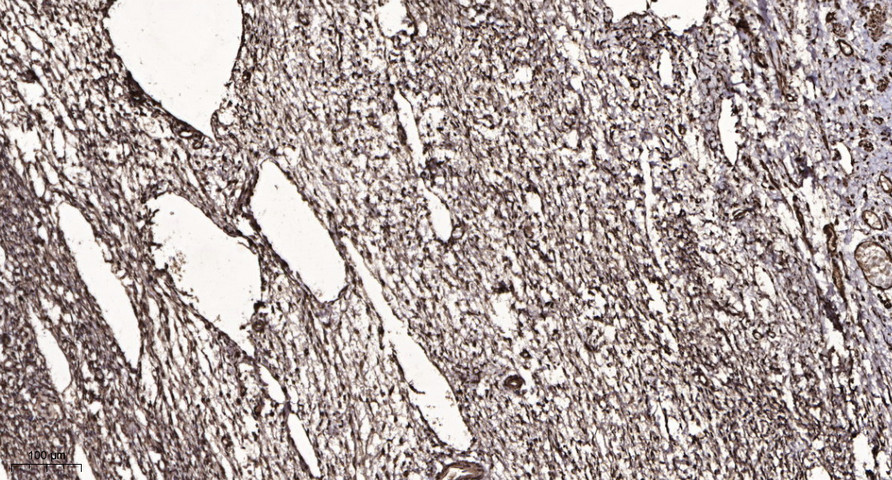 MYCNOS Polyclonal Antibody