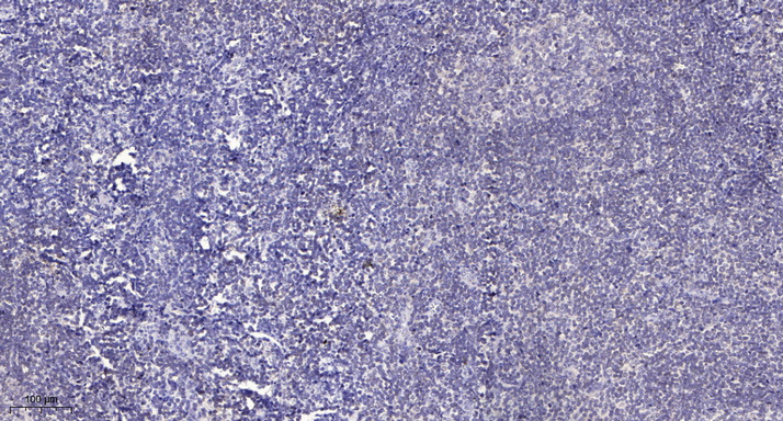 SH3BGRL3 Polyclonal Antibody