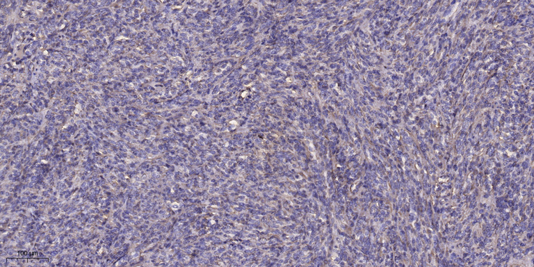S100A7 Polyclonal Antibody