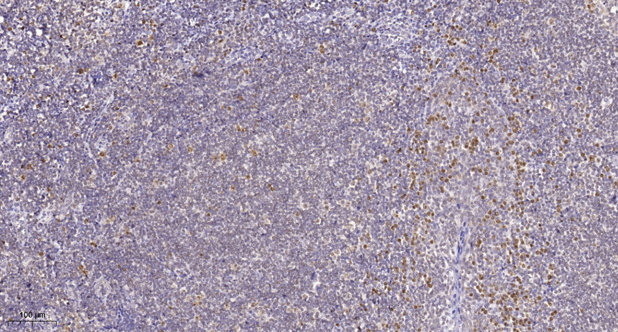 HMG-I/HMG-Y  Polyclonal Antibody