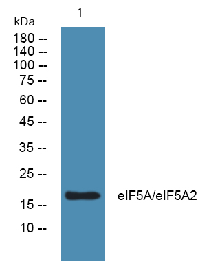 eIF5A/eIF5A2 Polyclonal Antibody