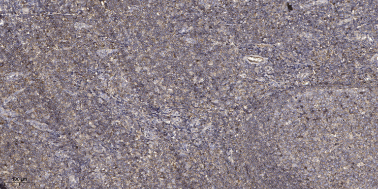 Thrombospondin 1 Polyclonal Antibody