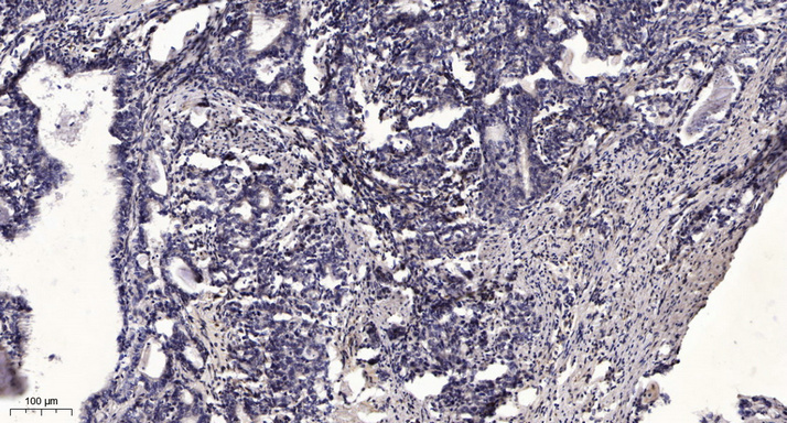 β-Tubulin Monoclonal Antibody(5G3), AbFluor 555 Conjugated