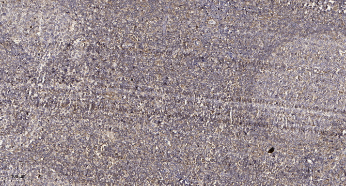 WIPI2 Rabbit Polyclonal Antibody