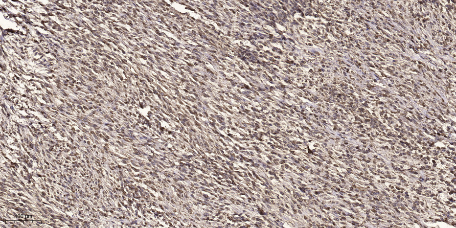 Acetyl NF kB P65(K314/K315) mouse Monoclonal Antibody(5G11)