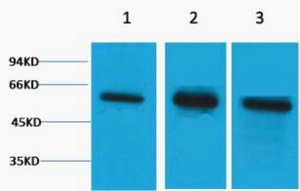 β Tubulin Polyclonal Antibody