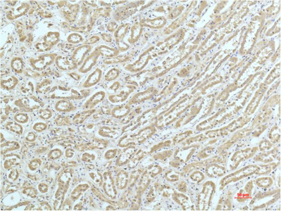 a-actinin Monoclonal Antibody(4A12)