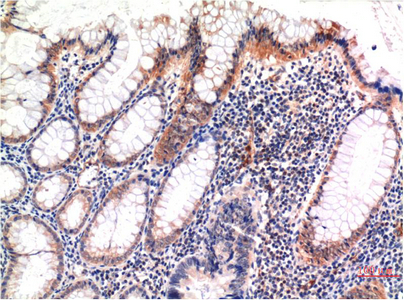 Phospho MLKL (S358) mouse Monoclonal Antibody(6F8)