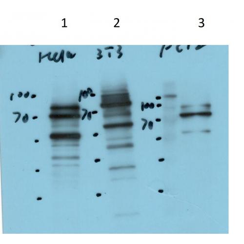 STIM1 Rabbit Polyclonal Antibody